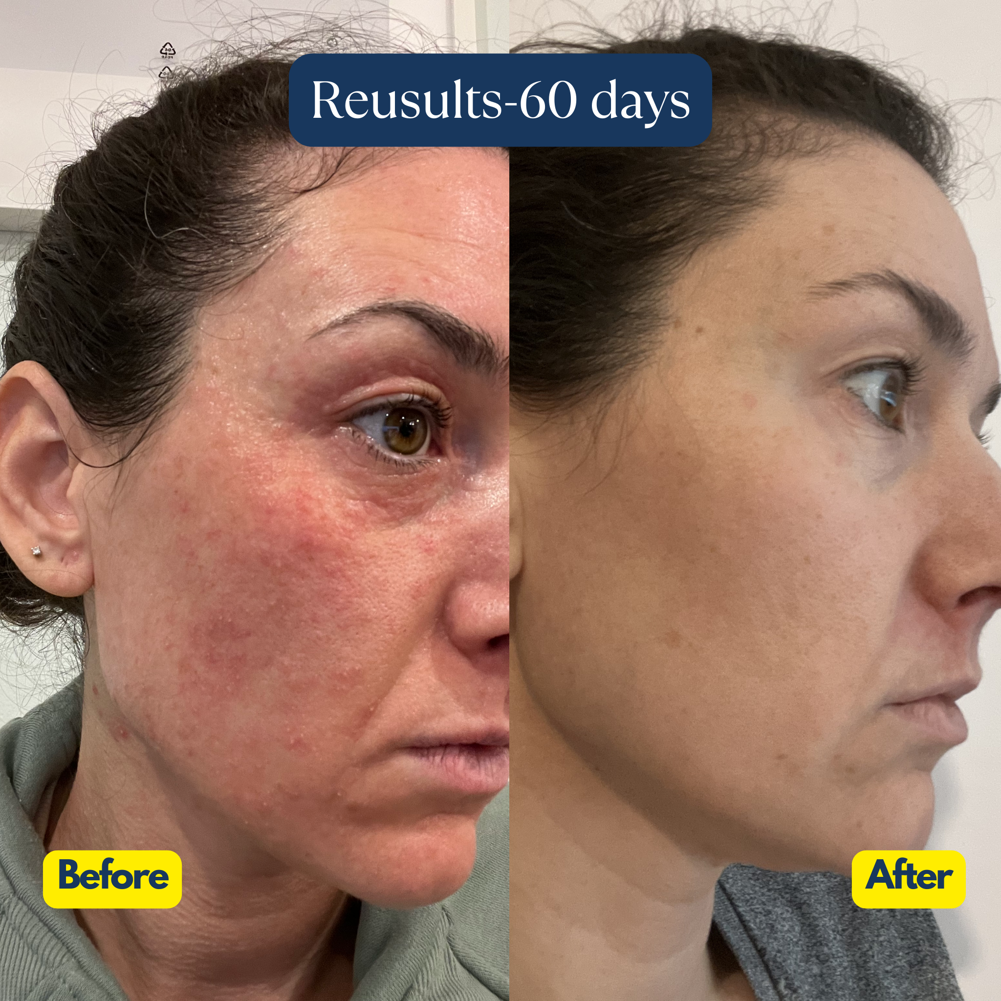 Abelin Pour & Shake Cleanser Starter Kit